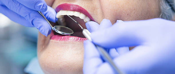 Best Emergency Dentist for Knocked-Out Tooth in Pine Hills, FL